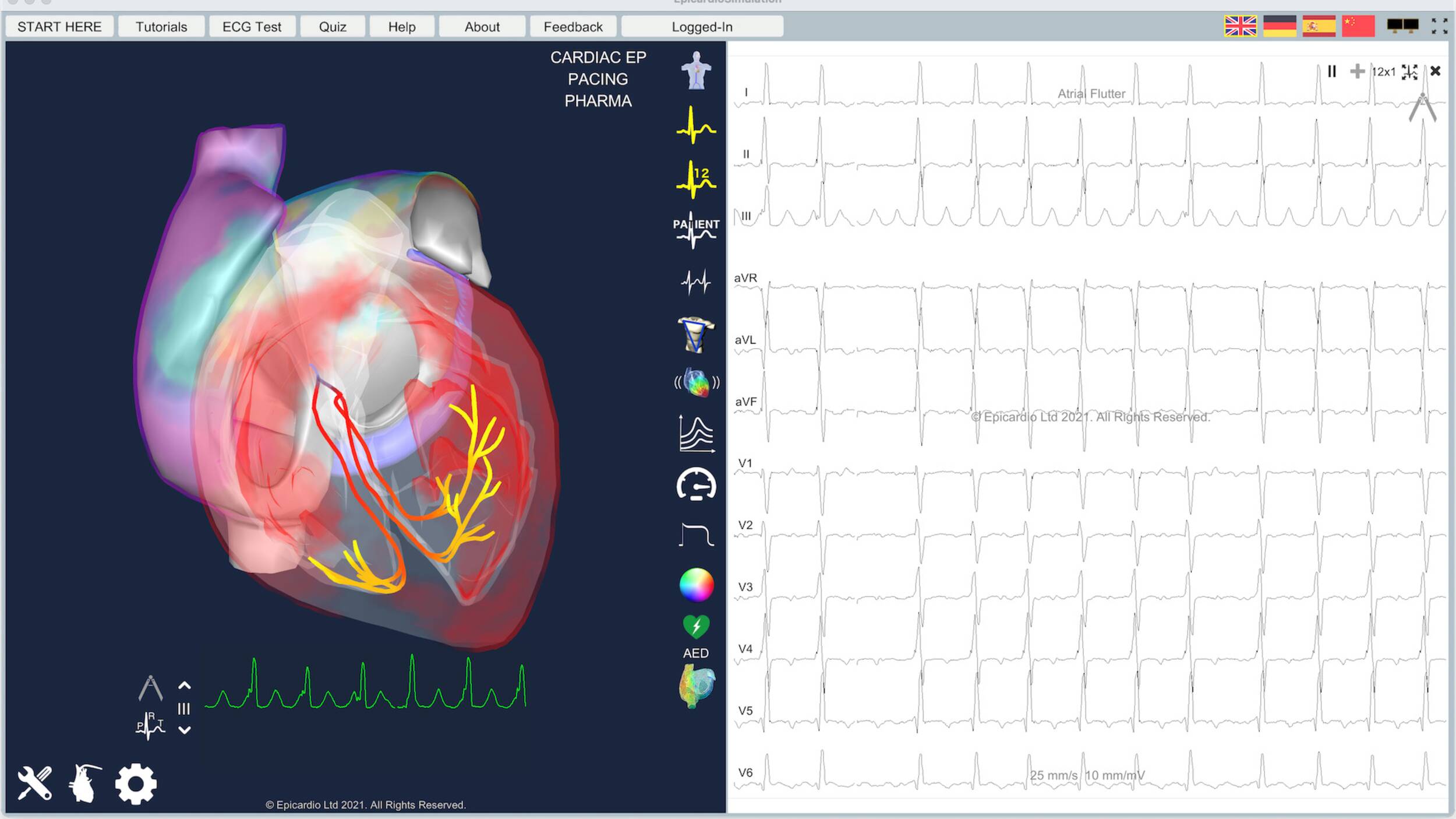 Epicardio ECG simulation | © Epicardio