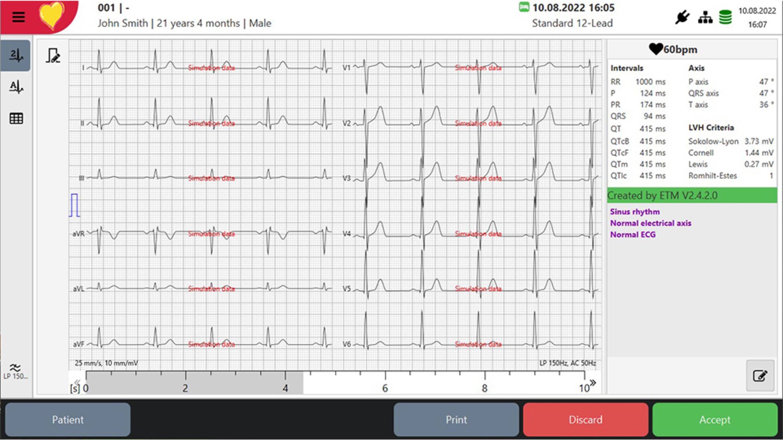 The innovative ECG analysis program for the clinical application and quality of ECG analysis