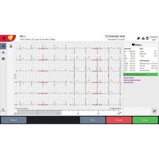 The innovative ECG analysis program for the clinical application and quality of ECG analysis