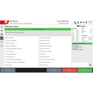 The automated ECG interpretation module designed for athletes