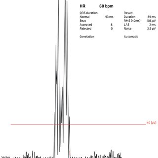 Analysis of Signal-Averaged ECG | © SCHILLER