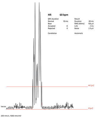 Analysis of Signal-Averaged ECG | © SCHILLER