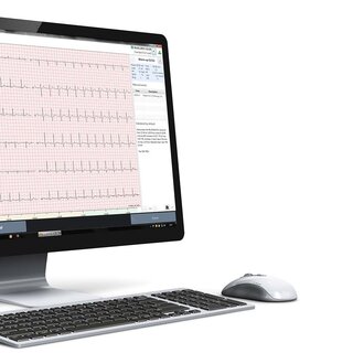 The SCHILLER Data Management System | © SCHILLER